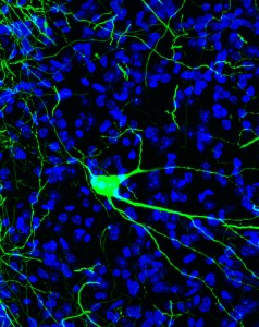 Research_confocal3